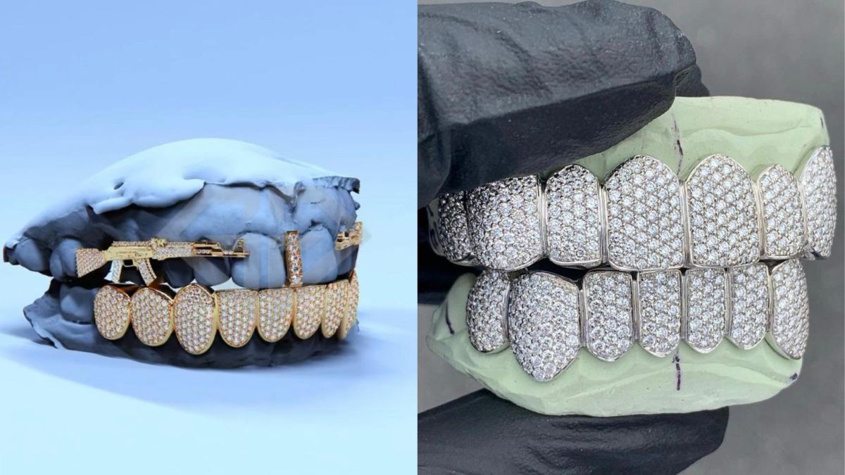 Feast with ‘Diamond Teeth’ in Surat