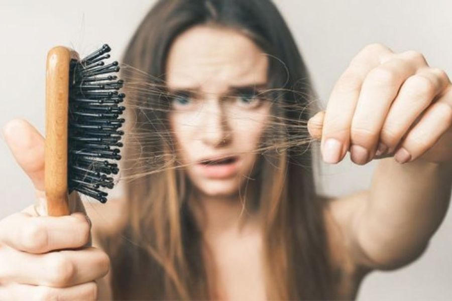 How you can treat PSCO-induced hair loss without side effects naturally with homeopathy
