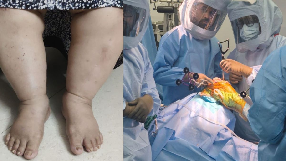 Dr Saikat Jena knee replacement surgery Mumbai, the blunt times