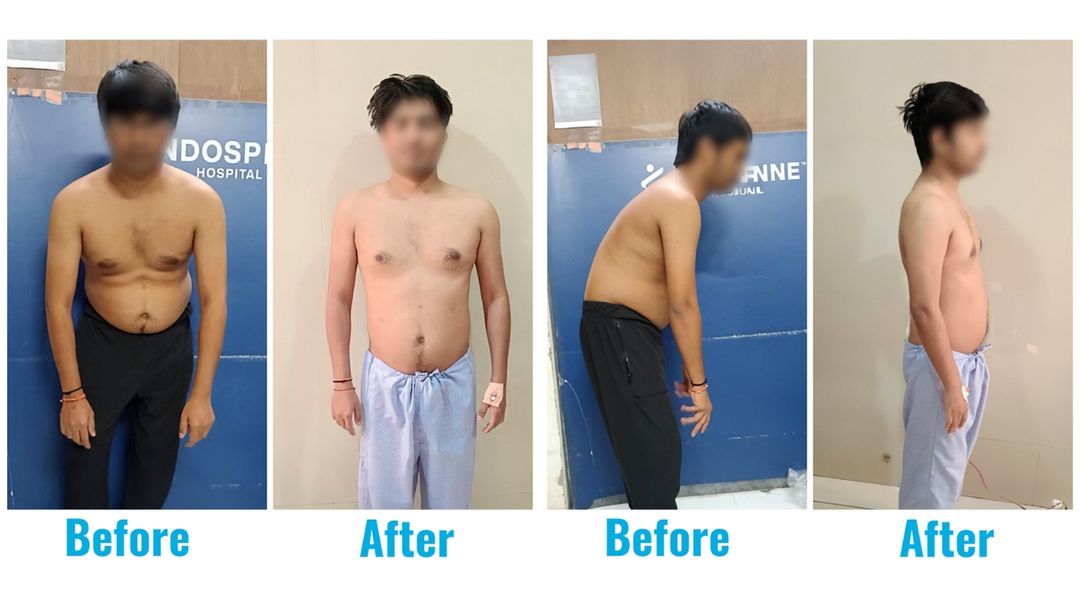 A 31-year-old who lived on a chair… until his spine finally said, ‘Enough' - TBT