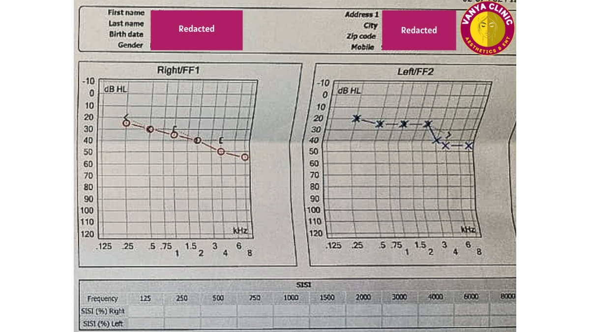 Dr. Purodha Prasad, ENT Specialist in Delhi Restores Sudden Hearing Loss in Patient Within 7 Days-TBT