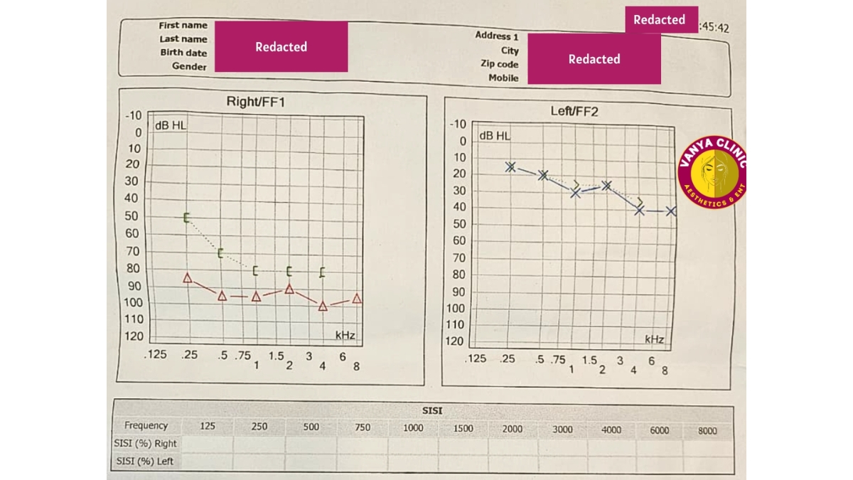 Dr. Purodha Prasad, ENT Specialist in Delhi Restores Sudden Hearing Loss in Patient Within 7 Days-TBT