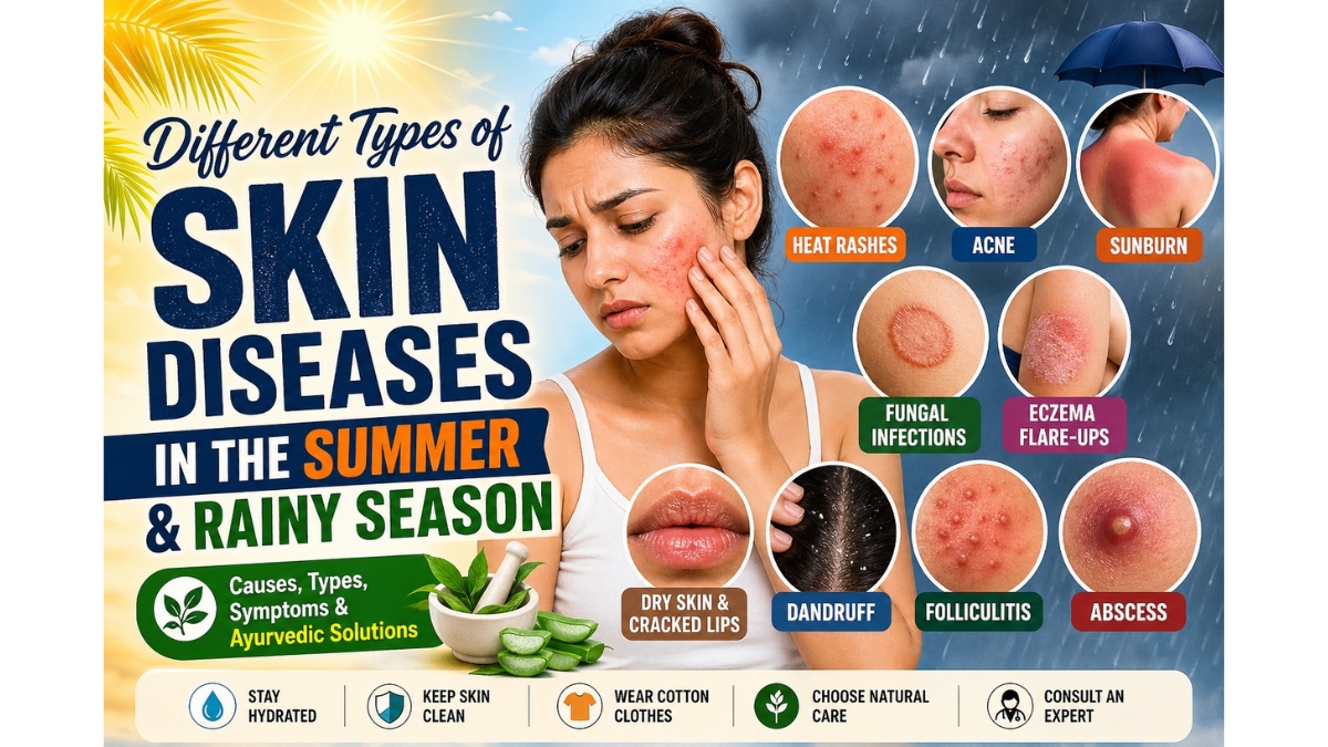 Different types of skin diseases in the Summer and Rainy Season-TBT