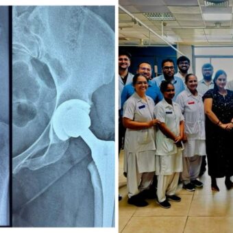 Ahmedabad Civil Hospital hip replacement, the blunt times